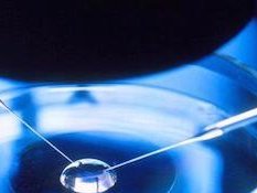 确诊为免疫性不孕能在灵武市做试管婴儿吗？做三代试管需要多少钱？