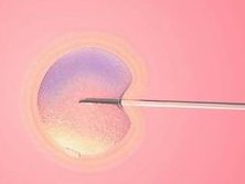 关于试管婴儿胚胎质量等级 试管婴儿的胚胎等级是怎么划分的？