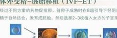 试管婴儿手术价格介绍 国内试管技术能做到选择吗